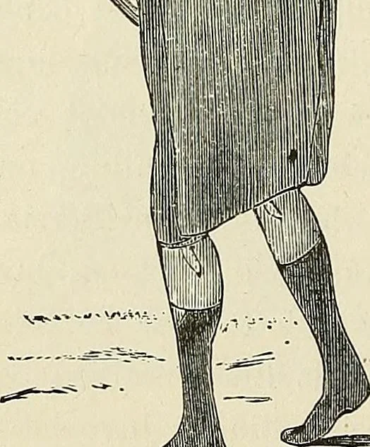 An illustration from Physiognomy illustrated; or, nature's revelations of character. A description of the mental, moral, and volitive dispositions of mankind, as manifested in the human form and countenance, 1887, leaf 399