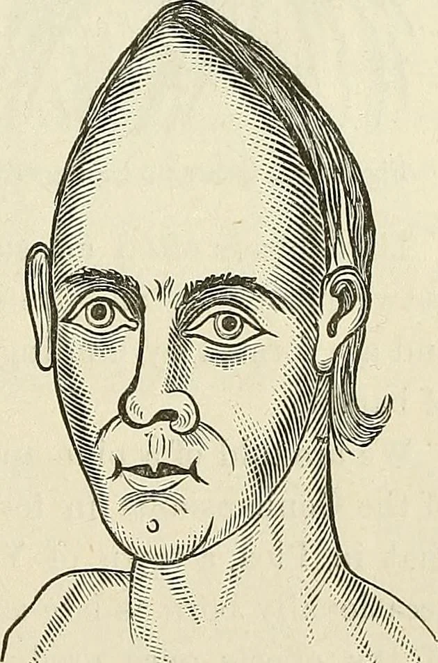 An illustration from Physiognomy illustrated; or, nature's revelations of character. A description of the mental, moral, and volitive dispositions of mankind, as manifested in the human form and countenance, 1887, leaf 536
