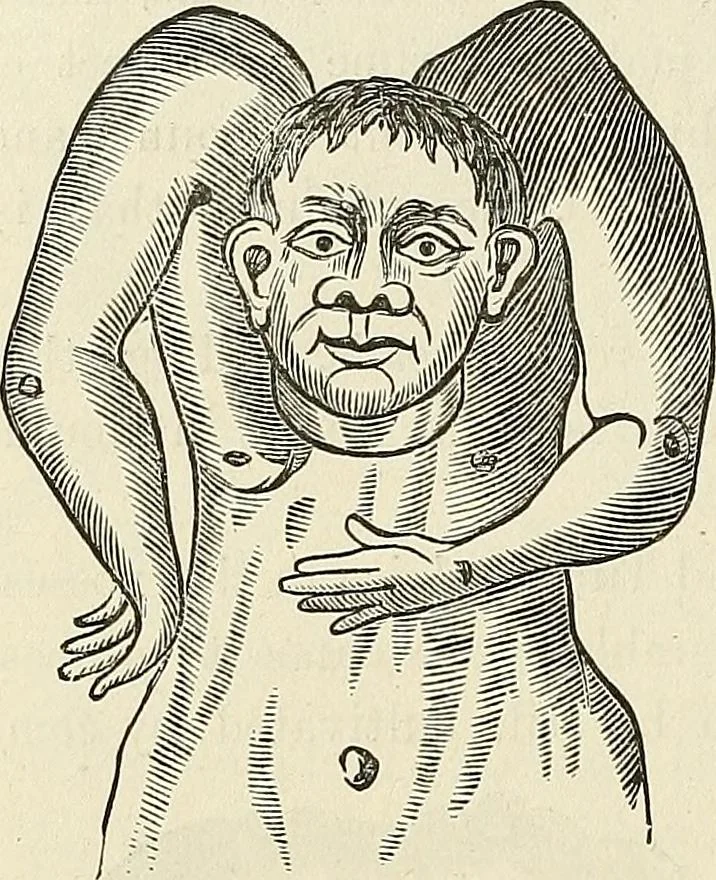 An illustration from Physiognomy illustrated; or, nature's revelations of character. A description of the mental, moral, and volitive dispositions of mankind, as manifested in the human form and countenance, 1887, leaf 541