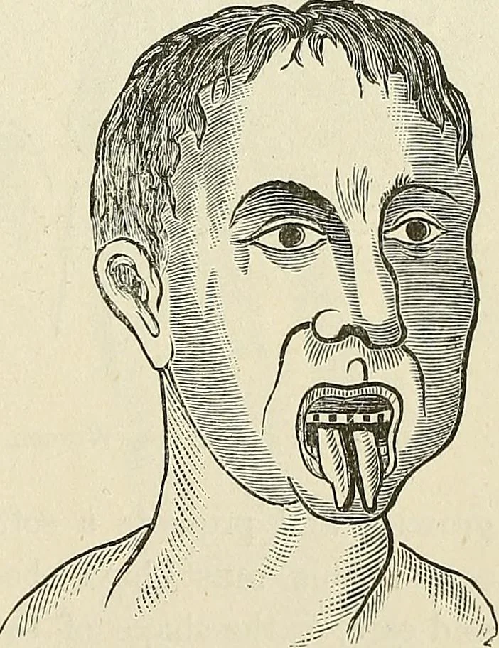 An illustration from Physiognomy illustrated; or, nature's revelations of character. A description of the mental, moral, and volitive dispositions of mankind, as manifested in the human form and countenance, 1887, leaf 546