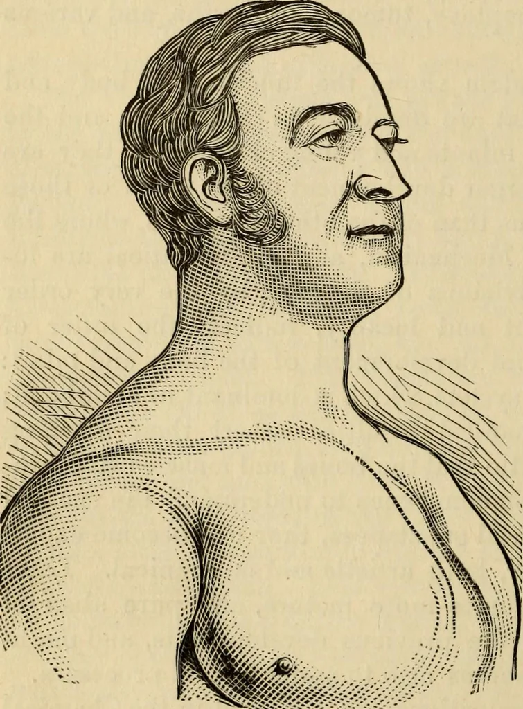 An illustration from Physiognomy : A practical and scientific treatise. Being a manual of instruction in the knowledge of the human physiognomy and organism, considered chemically, architecturally, and mathematically; embracing the discoveries of located traits, with their relative organs and signs of character, together with the three grand natural divisions of the human face, 1881, leaf 47