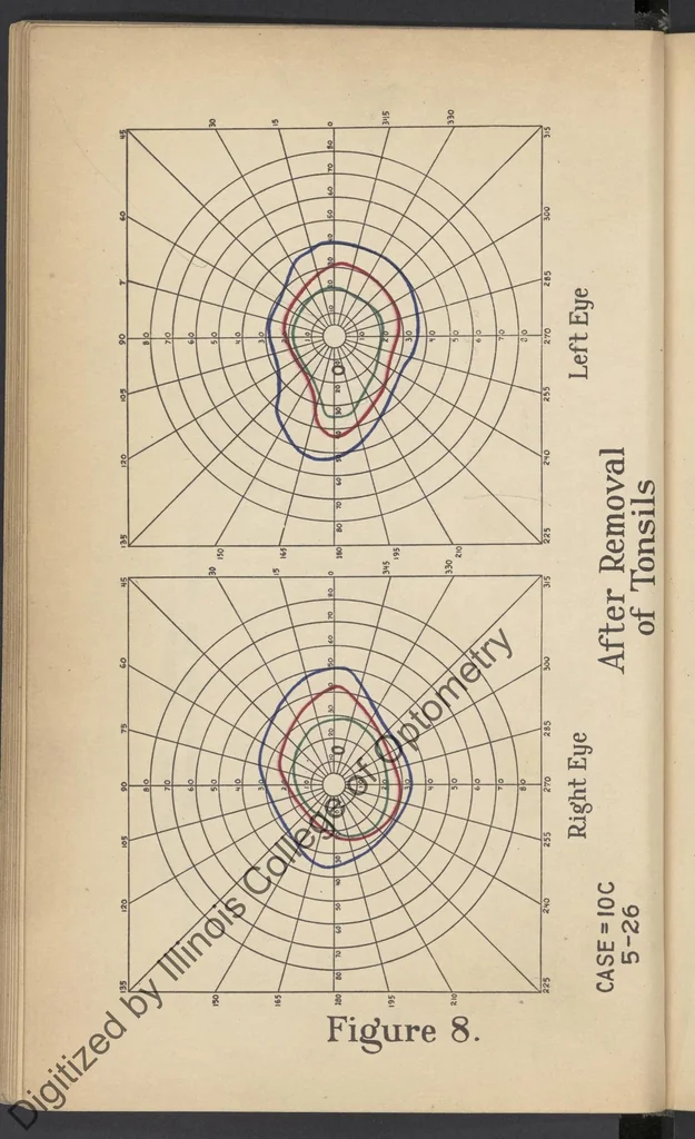 An illustration from Practical guide for charting and interpreting the visual color fields, 1928, leaf 56