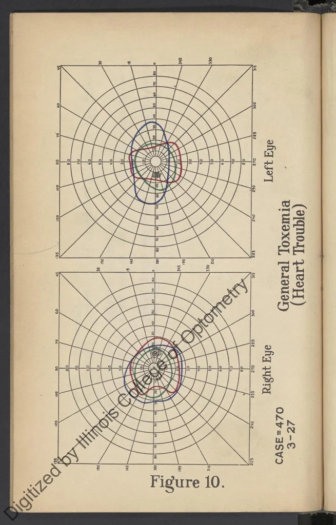 An illustration from Practical guide for charting and interpreting the visual color fields, 1928, leaf 61