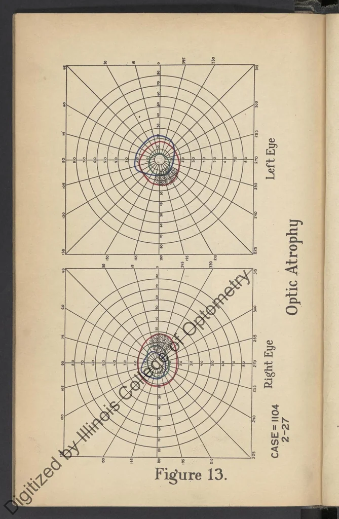 An illustration from Practical guide for charting and interpreting the visual color fields, 1928, leaf 70
