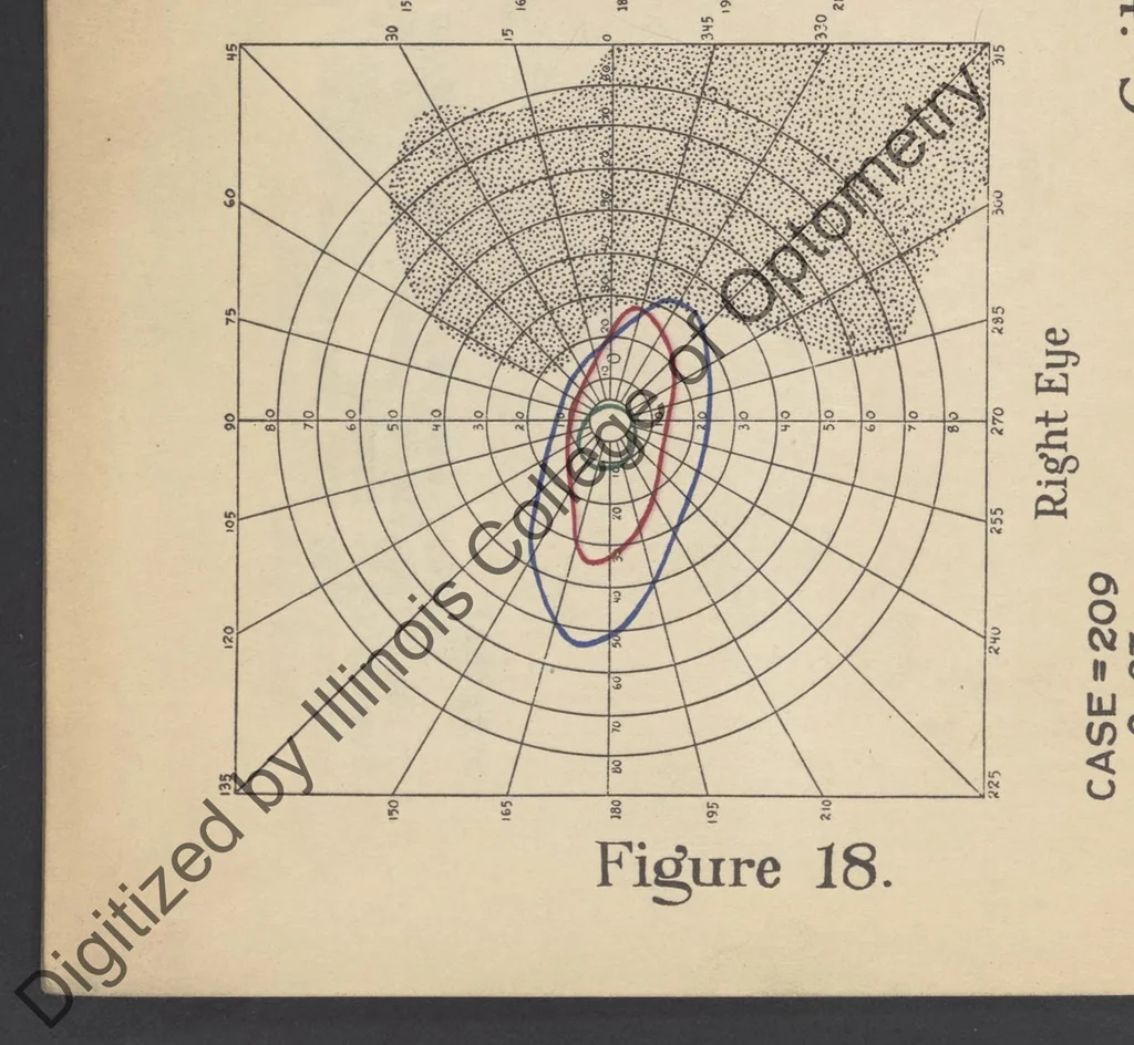 An illustration from Practical guide for charting and interpreting the visual color fields, 1928, leaf 82