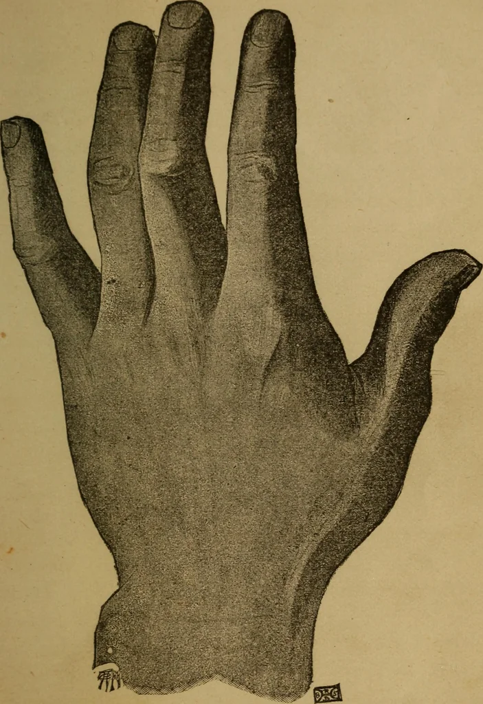 An illustration from Practical cheirosophy, a synoptical study of the science of the hand, 1887, leaf 68