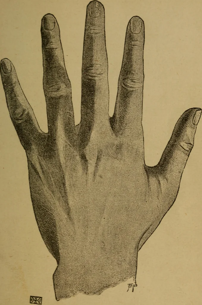 An illustration from Practical cheirosophy, a synoptical study of the science of the hand, 1887, leaf 76