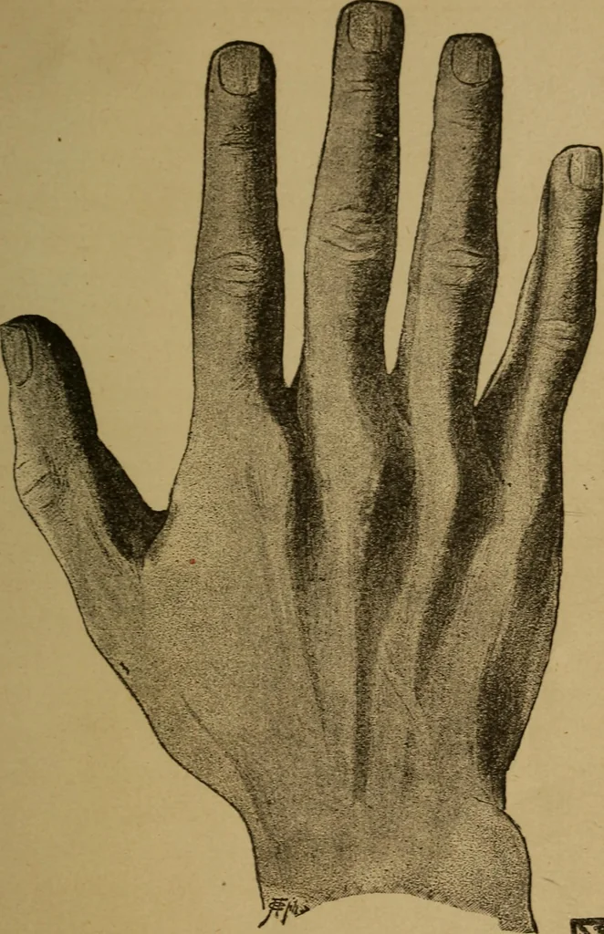 An illustration from Practical cheirosophy, a synoptical study of the science of the hand, 1887, leaf 80
