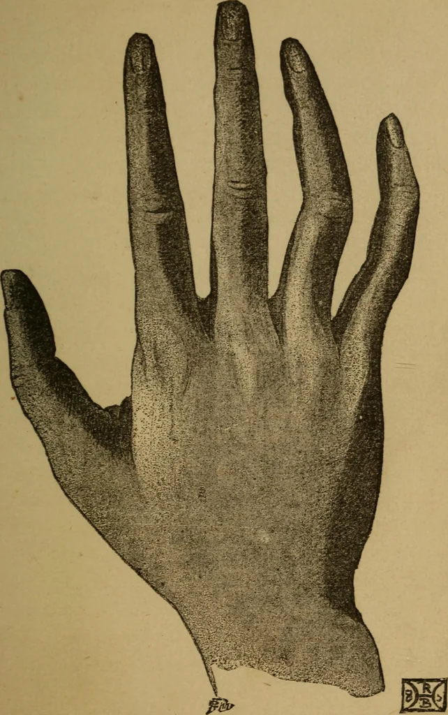 An illustration from Practical cheirosophy, a synoptical study of the science of the hand, 1887, leaf 88