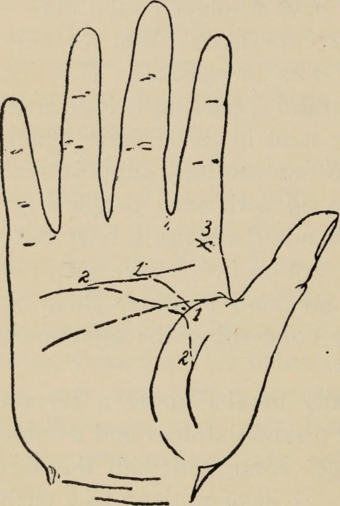 An illustration from Practical palmistry : a reliable treatise on the art of character reading and methods of recalling past and foretelling future events upon examination of the hand, 1904, leaf 111