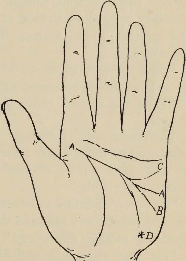 An illustration from Practical palmistry : a reliable treatise on the art of character reading and methods of recalling past and foretelling future events upon examination of the hand, 1904, leaf 124