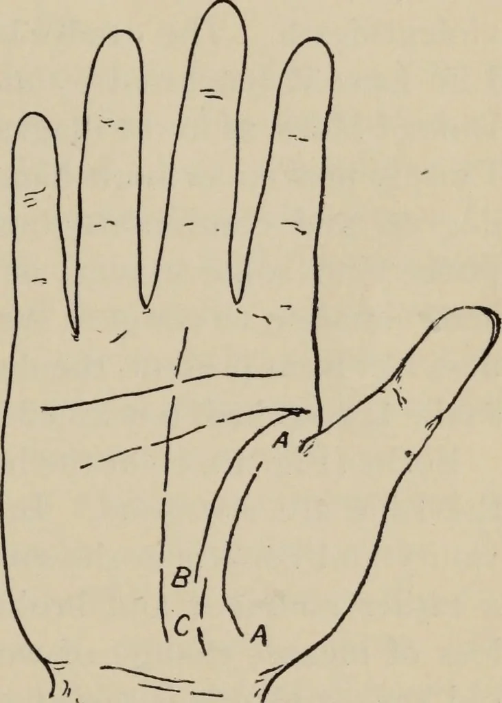 An illustration from Practical palmistry : a reliable treatise on the art of character reading and methods of recalling past and foretelling future events upon examination of the hand, 1904, leaf 138