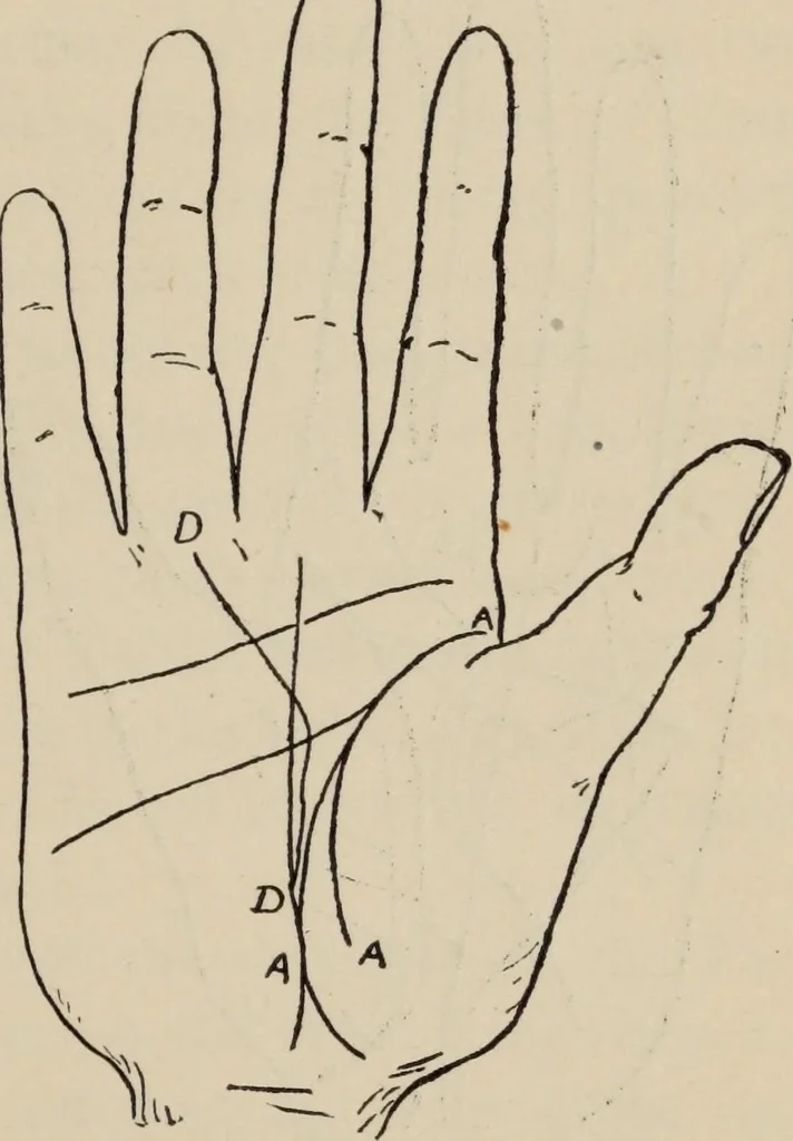 An illustration from Practical palmistry : a reliable treatise on the art of character reading and methods of recalling past and foretelling future events upon examination of the hand, 1904, leaf 146