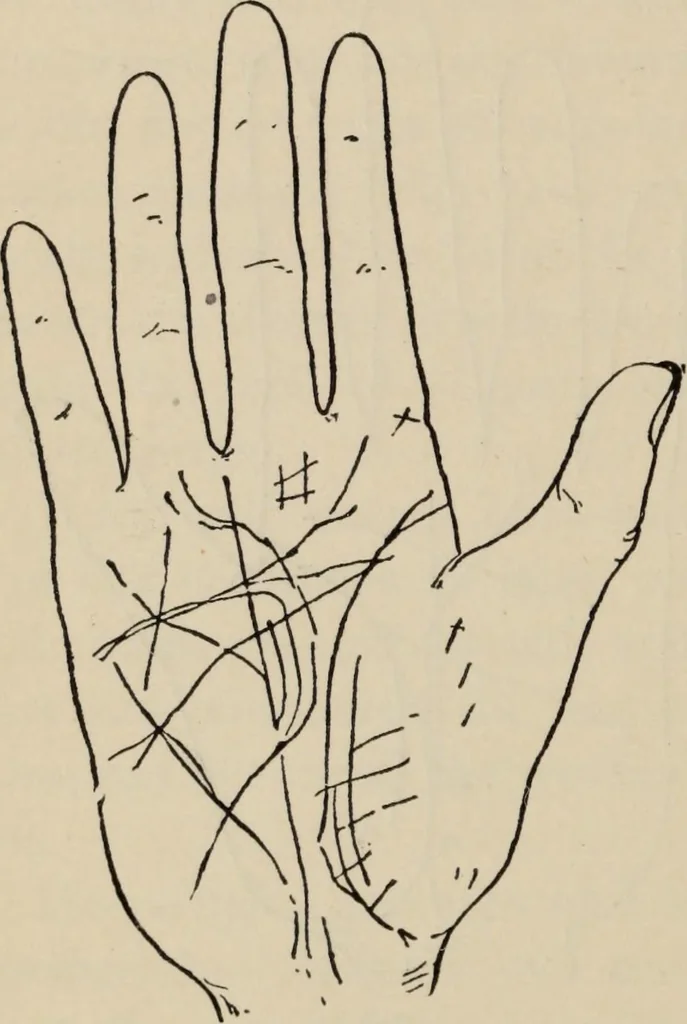 An illustration from Practical palmistry : a reliable treatise on the art of character reading and methods of recalling past and foretelling future events upon examination of the hand, 1904, leaf 147