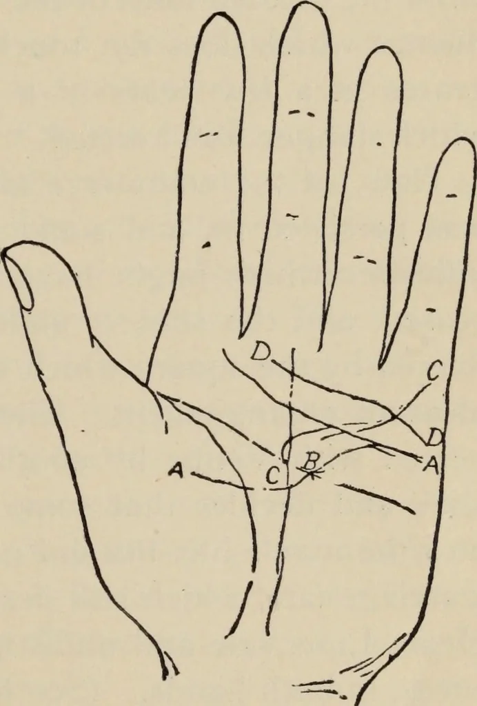 An illustration from Practical palmistry : a reliable treatise on the art of character reading and methods of recalling past and foretelling future events upon examination of the hand, 1904, leaf 150