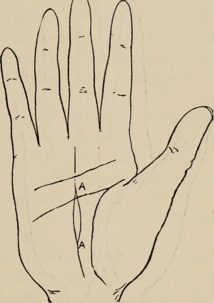 An illustration from Practical palmistry : a reliable treatise on the art of character reading and methods of recalling past and foretelling future events upon examination of the hand, 1904, leaf 160