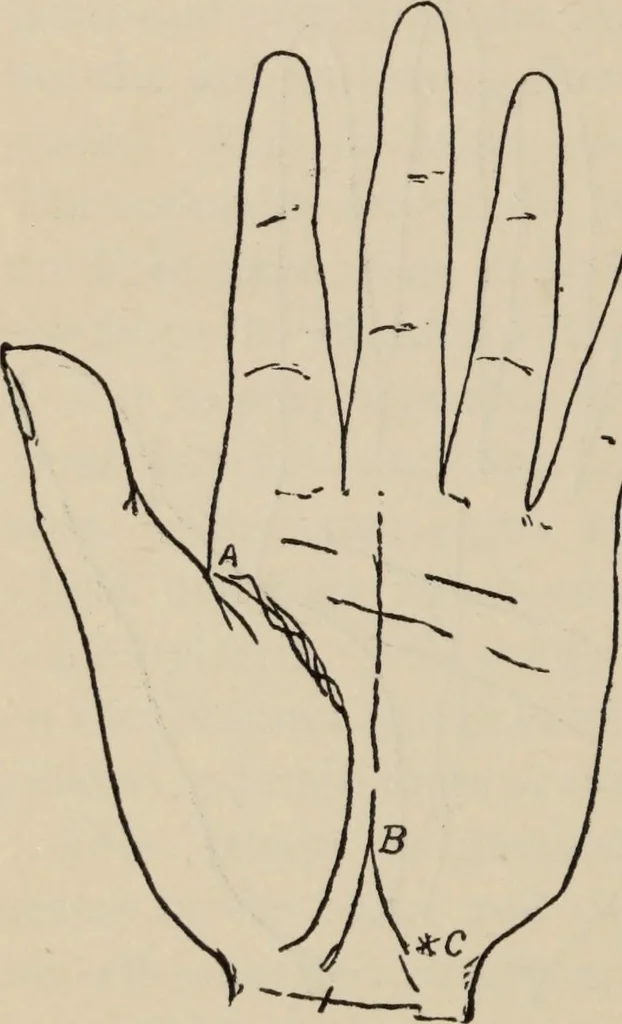 An illustration from Practical palmistry : a reliable treatise on the art of character reading and methods of recalling past and foretelling future events upon examination of the hand, 1904, leaf 161