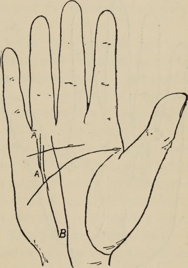 An illustration from Practical palmistry : a reliable treatise on the art of character reading and methods of recalling past and foretelling future events upon examination of the hand, 1904, leaf 174