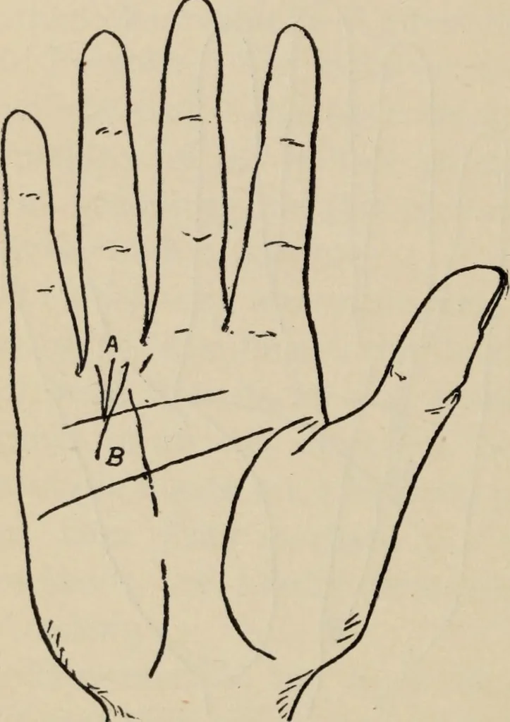 An illustration from Practical palmistry : a reliable treatise on the art of character reading and methods of recalling past and foretelling future events upon examination of the hand, 1904, leaf 175