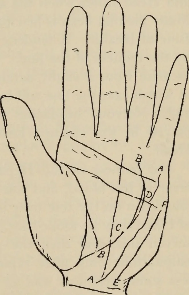 An illustration from Practical palmistry : a reliable treatise on the art of character reading and methods of recalling past and foretelling future events upon examination of the hand, 1904, leaf 178