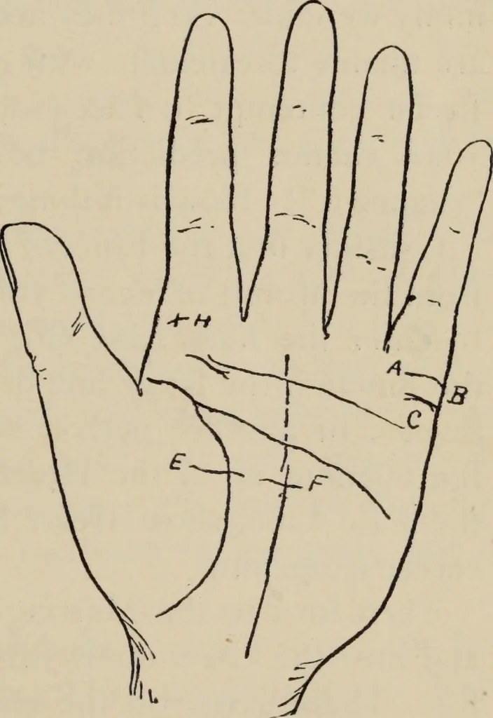 An illustration from Practical palmistry : a reliable treatise on the art of character reading and methods of recalling past and foretelling future events upon examination of the hand, 1904, leaf 194