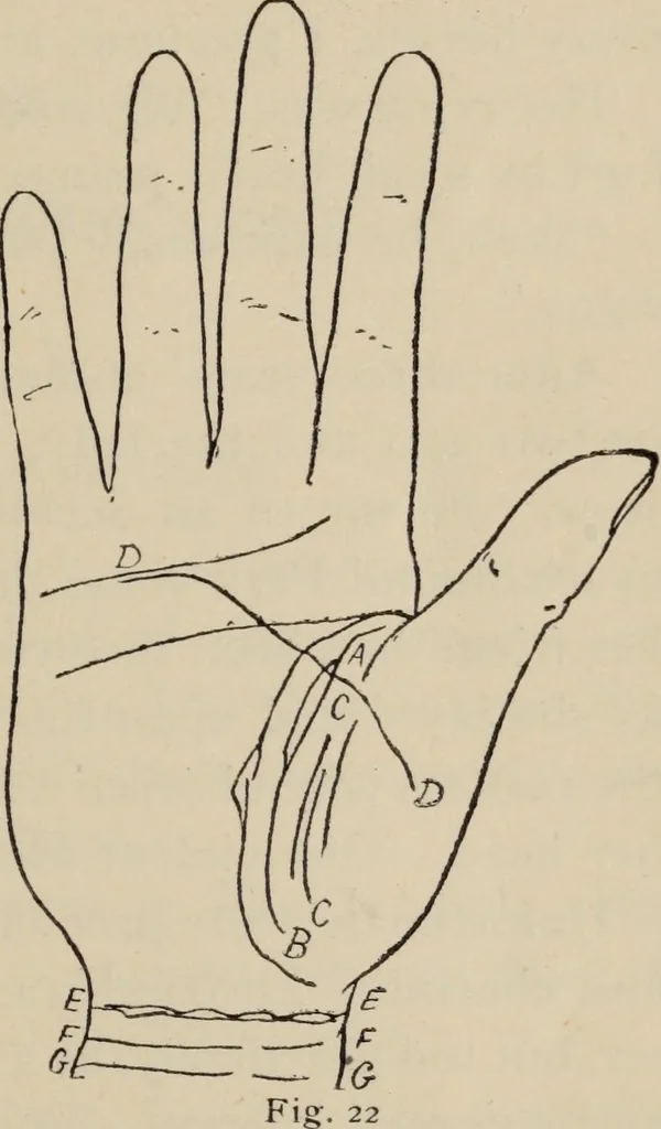 An illustration from Practical palmistry : a reliable treatise on the art of character reading and methods of recalling past and foretelling future events upon examination of the hand, 1904, leaf 202