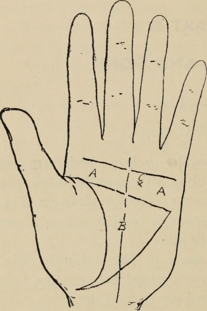 An illustration from Practical palmistry : a reliable treatise on the art of character reading and methods of recalling past and foretelling future events upon examination of the hand, 1904, leaf 205