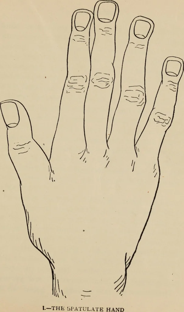 An illustration from Practical palmistry : a reliable treatise on the art of character reading and methods of recalling past and foretelling future events upon examination of the hand, 1904, leaf 30