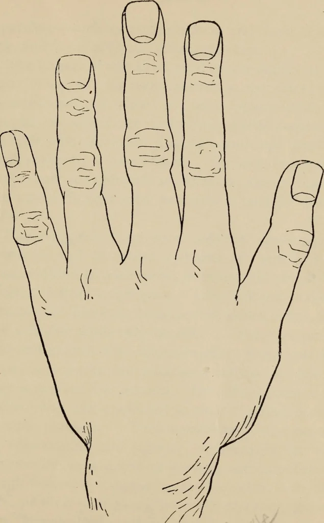An illustration from Practical palmistry : a reliable treatise on the art of character reading and methods of recalling past and foretelling future events upon examination of the hand, 1904, leaf 34