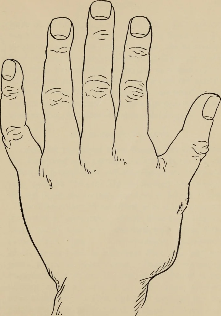 An illustration from Practical palmistry : a reliable treatise on the art of character reading and methods of recalling past and foretelling future events upon examination of the hand, 1904, leaf 44