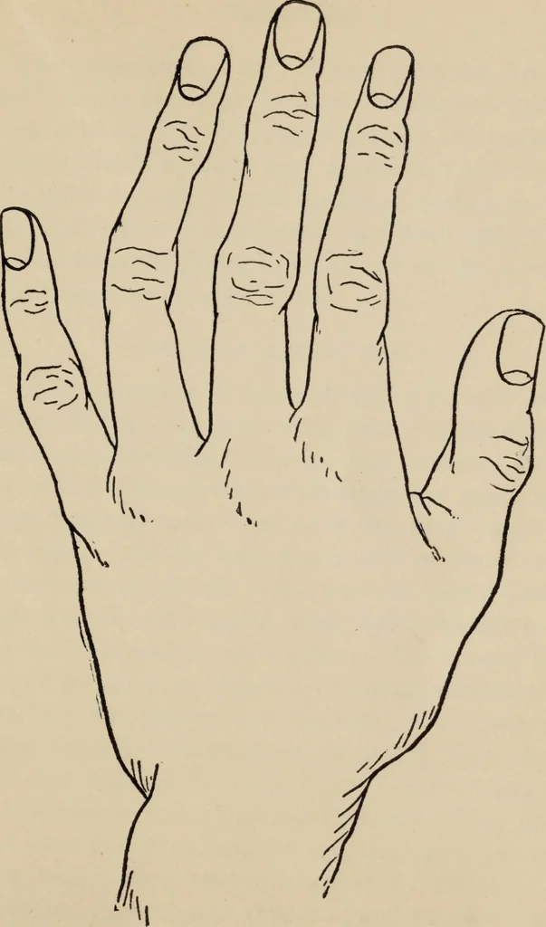 An illustration from Practical palmistry : a reliable treatise on the art of character reading and methods of recalling past and foretelling future events upon examination of the hand, 1904, leaf 50