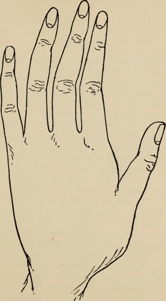 An illustration from Practical palmistry : a reliable treatise on the art of character reading and methods of recalling past and foretelling future events upon examination of the hand, 1904, leaf 54