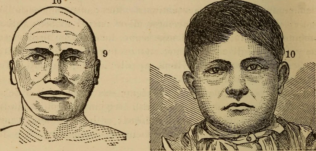 An illustration from The practical phrenologist and recorder and delineator of the character and talents of [blank], as marked by [blank] : a compendium of phreno-organic science, 1869, leaf 101