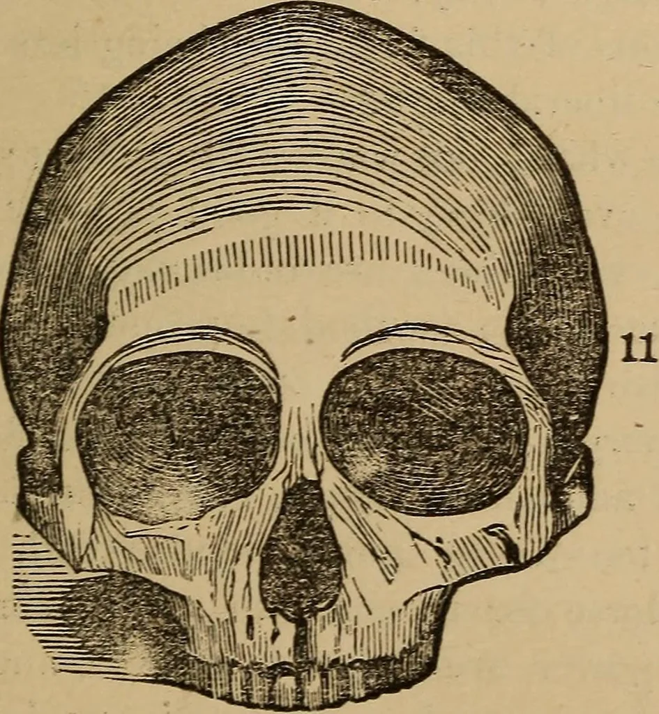 An illustration from The practical phrenologist and recorder and delineator of the character and talents of [blank], as marked by [blank] : a compendium of phreno-organic science, 1869, leaf 106