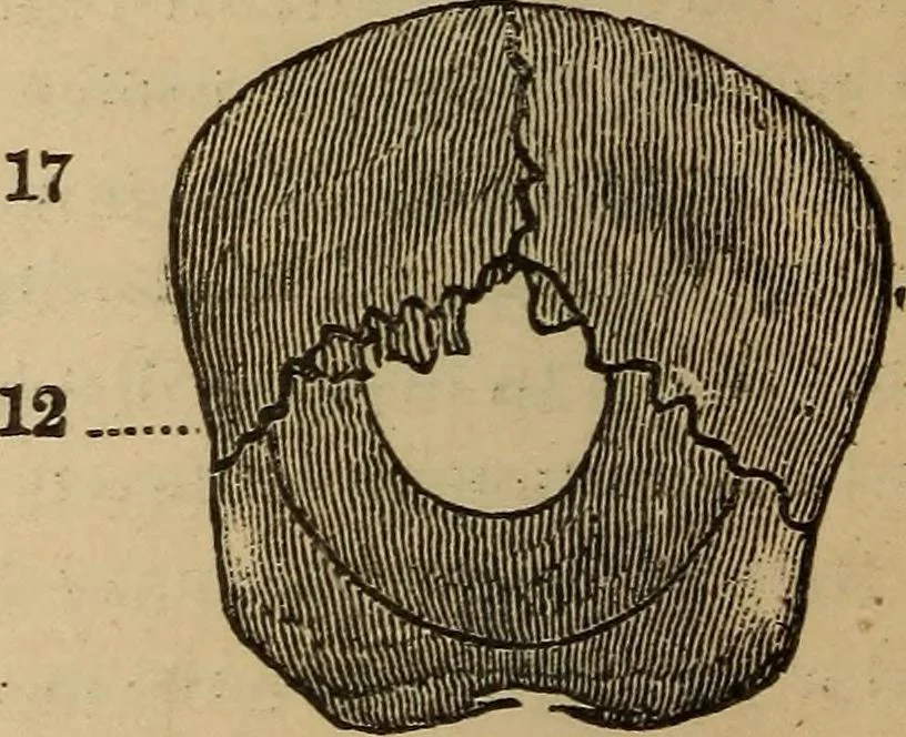 An illustration from The practical phrenologist and recorder and delineator of the character and talents of [blank], as marked by [blank] : a compendium of phreno-organic science, 1869, leaf 109
