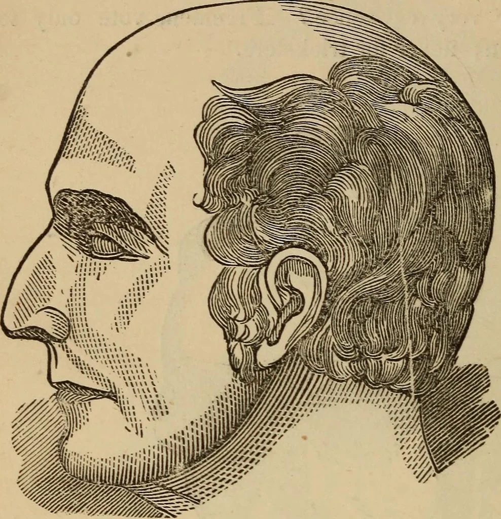 An illustration from The practical phrenologist and recorder and delineator of the character and talents of [blank], as marked by [blank] : a compendium of phreno-organic science, 1869, leaf 65