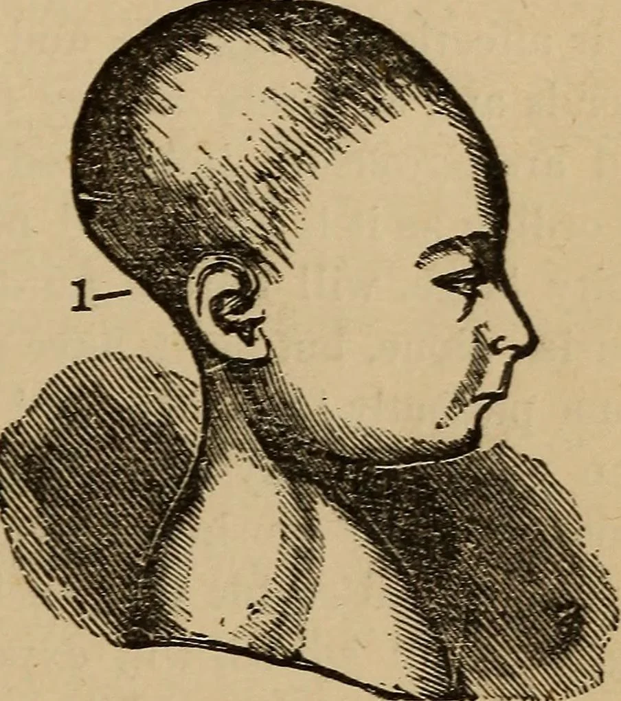 An illustration from The practical phrenologist and recorder and delineator of the character and talents of [blank], as marked by [blank] : a compendium of phreno-organic science, 1869, leaf 80
