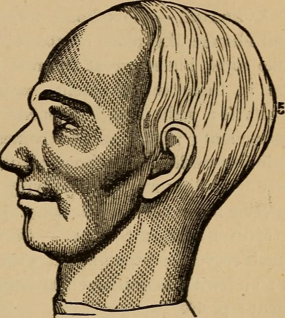 An illustration from The practical phrenologist and recorder and delineator of the character and talents of [blank], as marked by [blank] : a compendium of phreno-organic science, 1869, leaf 92