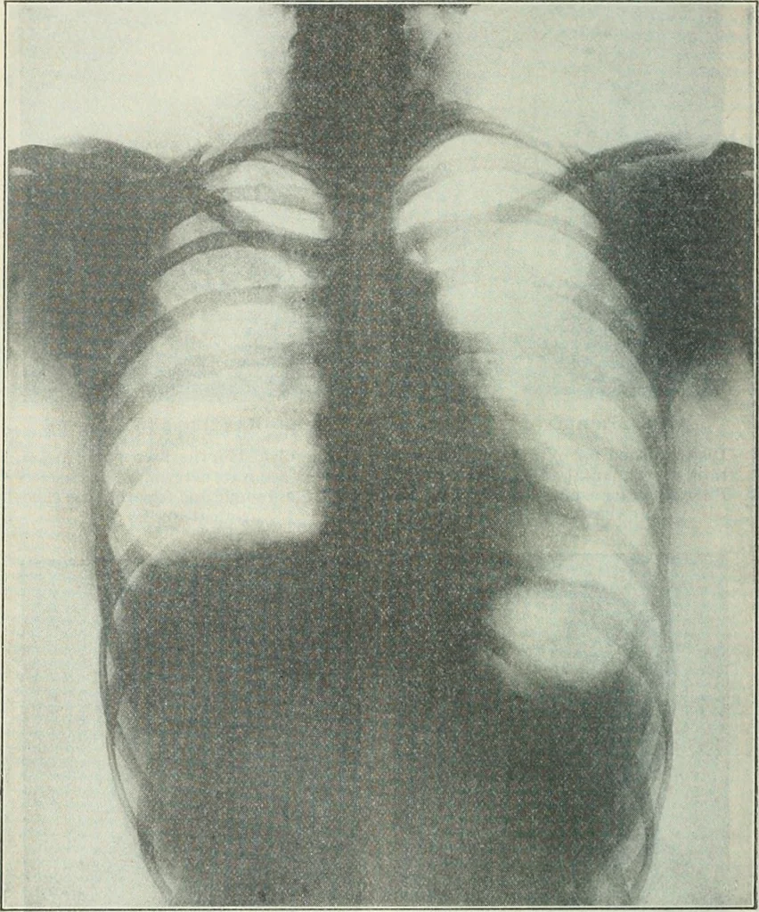 An illustration from Practical physics, 1922, leaf 413