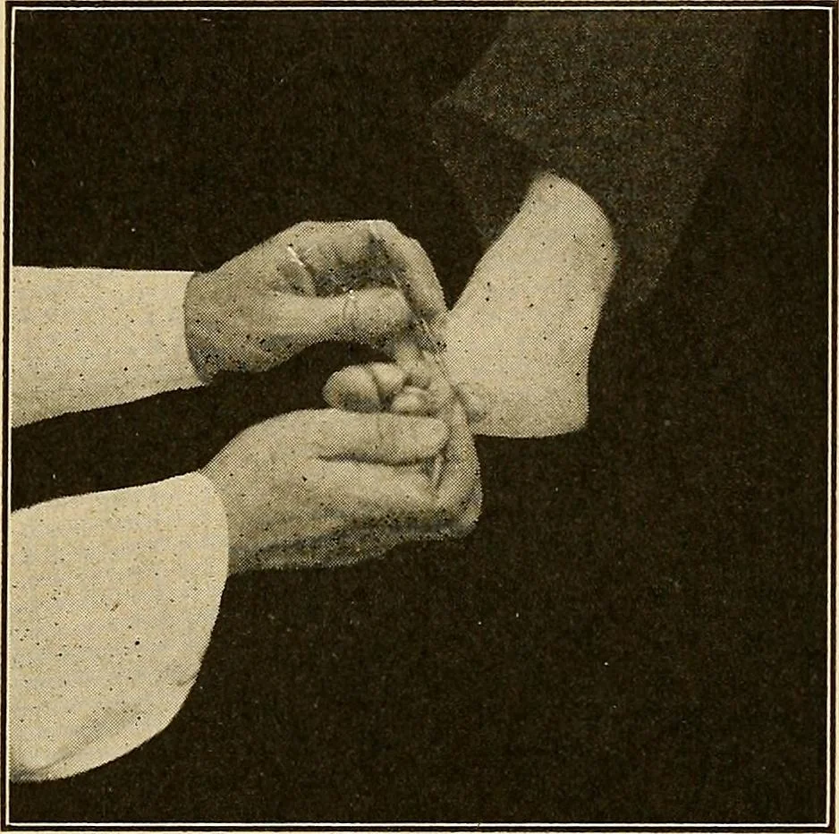 An illustration from Practical podiatry :, 1918, leaf 176