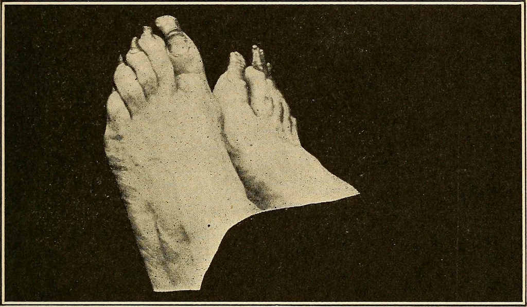 An illustration from Practical podiatry :, 1918, leaf 256