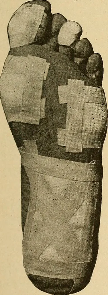 An illustration from Practical podiatry :, 1918, leaf 80