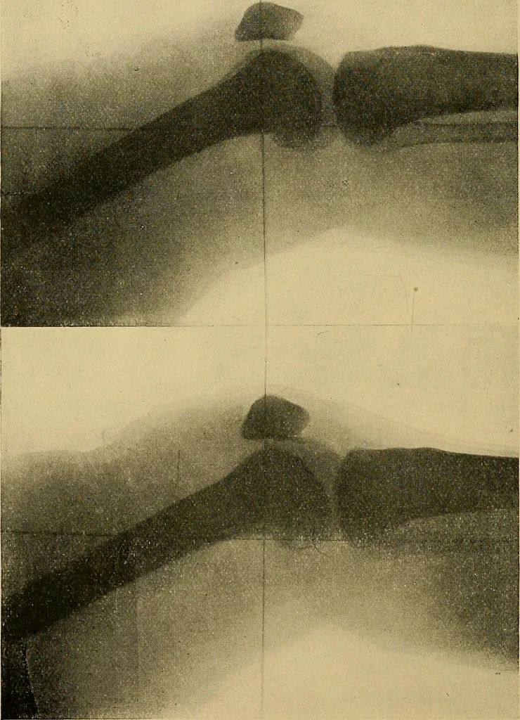 An illustration from Practical radiography : a handbook for physicians, surgeons, and other users of X-rays, 1901, leaf 79