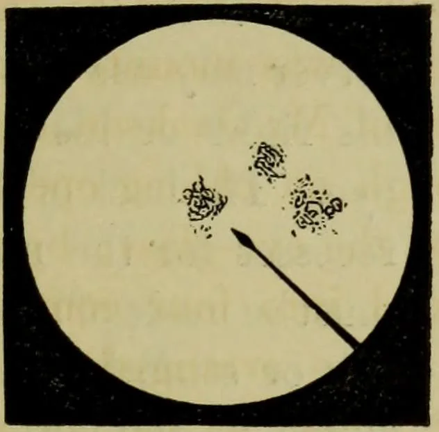 An illustration from A practical treatise on the use of the microscope, including the different methods of preparing and examining animal, vegetable, and mineral structures, 1848, leaf 172