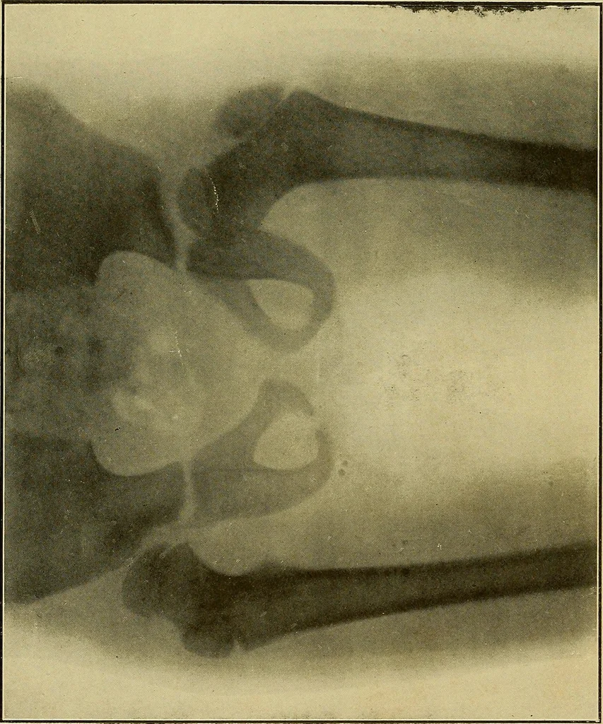 An illustration from Practical X ray work, 1901, leaf 11