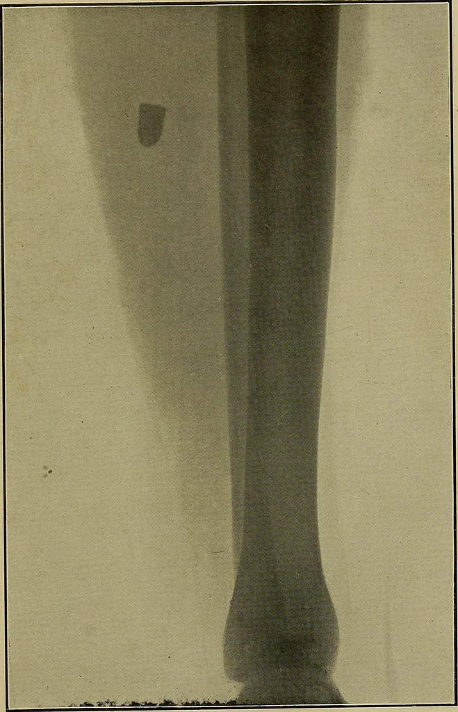 An illustration from Practical X ray work, 1901, leaf 138