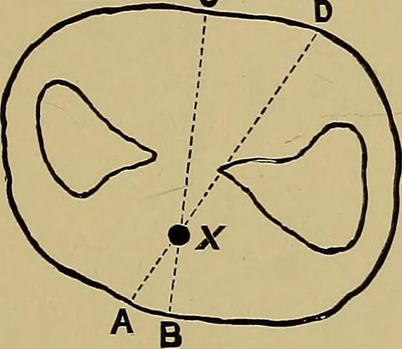 An illustration from Practical X ray work, 1901, leaf 178