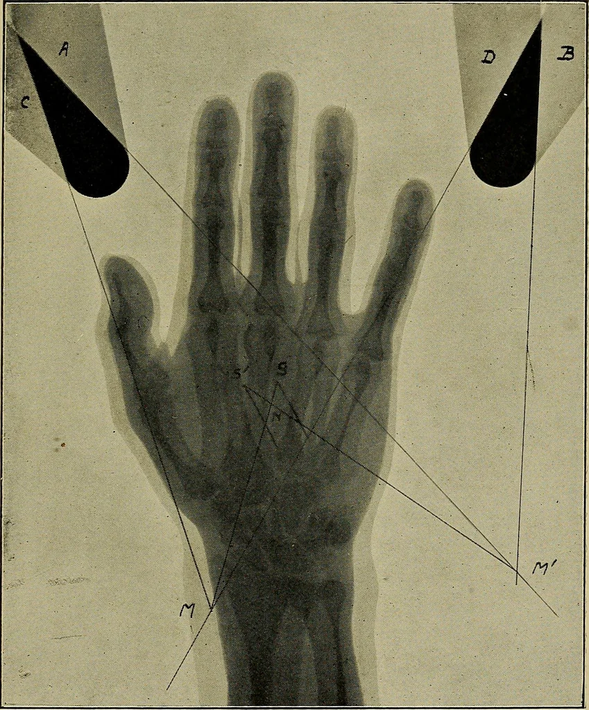 An illustration from Practical X ray work, 1901, leaf 230