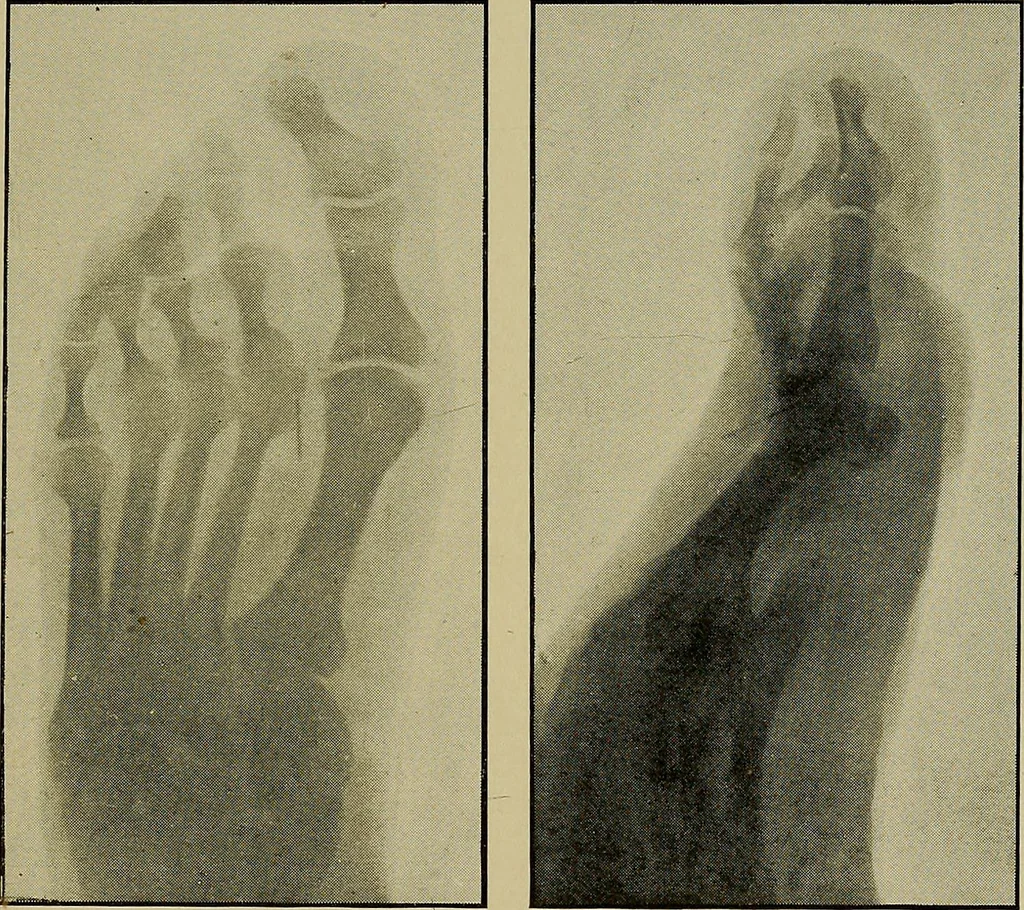 An illustration from Practical X ray work, 1901, leaf 48