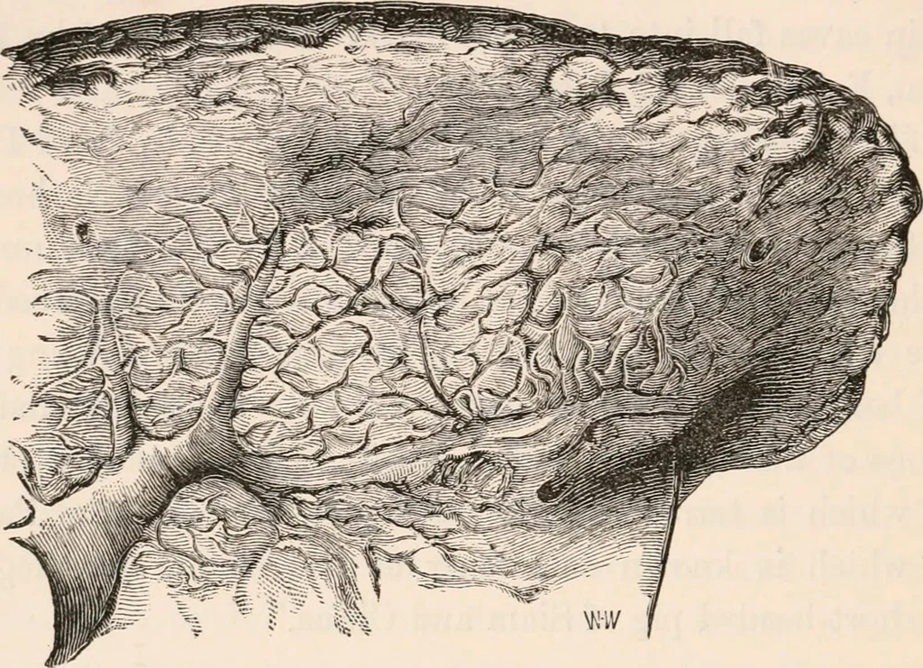 An illustration from Pre-historic times, as illustrated by ancient remains and the manners and customs of modern savages, 1892, leaf 243